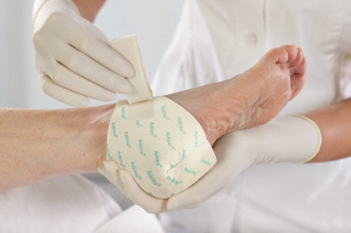 CONVERSEMOS DE MANEJO DE HERIDAS CRÓNICAS